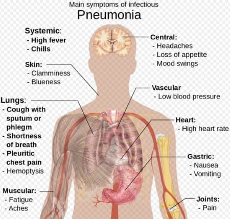 Chart Of Infectious Bacteria And Diseases Caused By Them