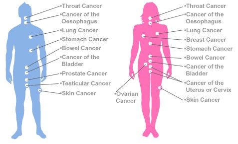 Types of Cancer